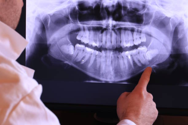 Best Dentist for Tooth Abscess  in Harrisonville, MO